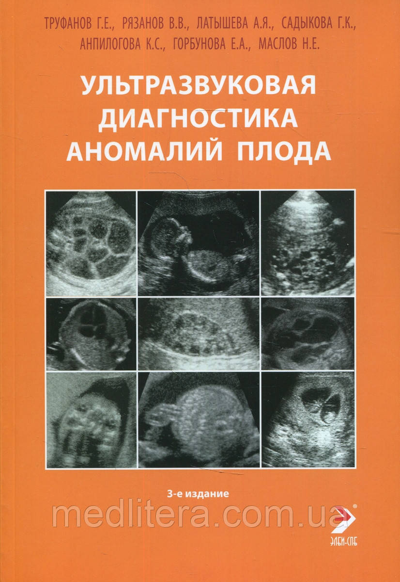 Р. Труфанов, Володимир Рязанов, Д. Іванов, А.с ЛатышеваУЗИ аномалій плоду