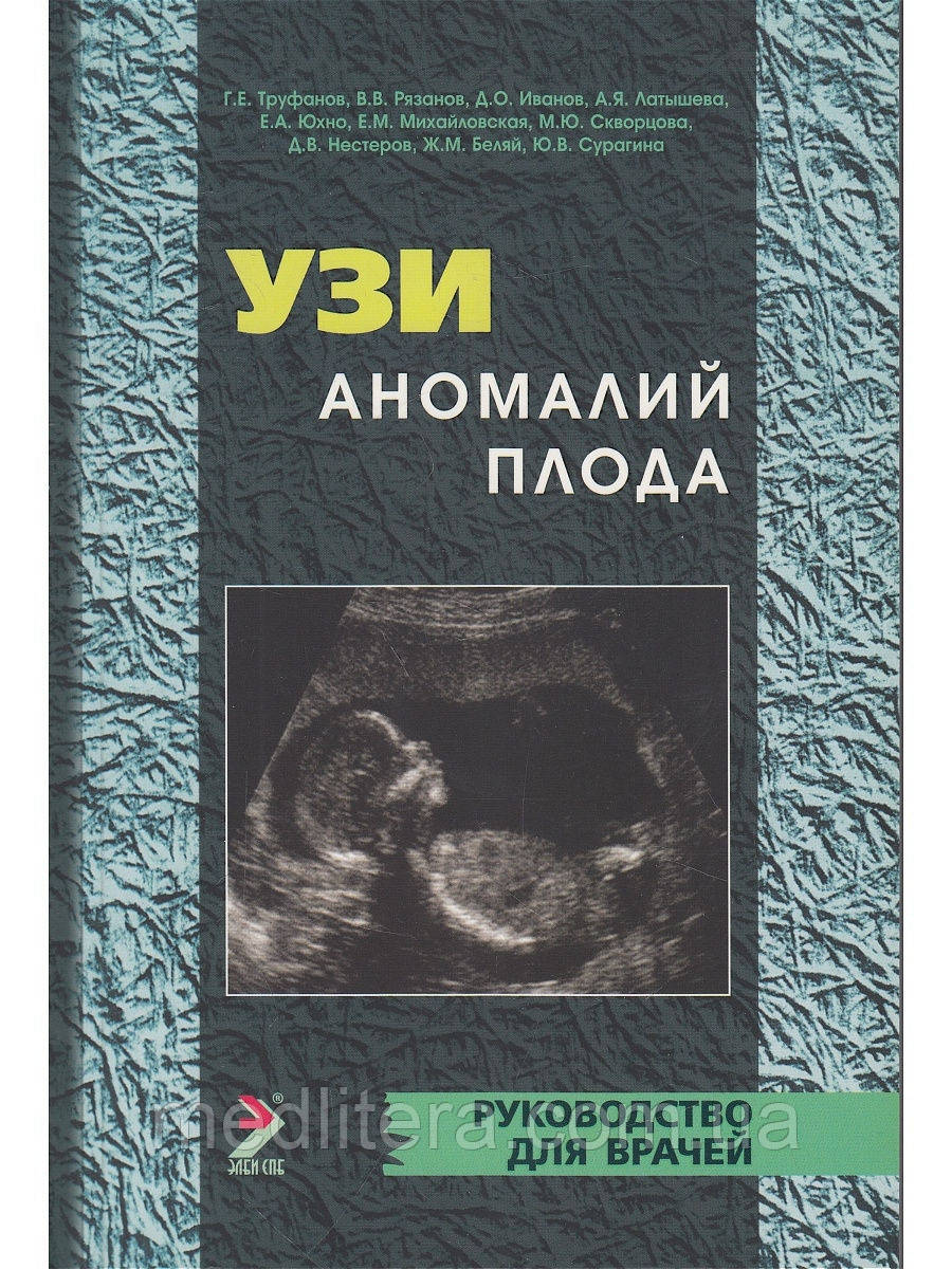 Г. Труфанів, Володимир Рязанів, Д. Іванів, А. Латешова УЗІ аномалій плода