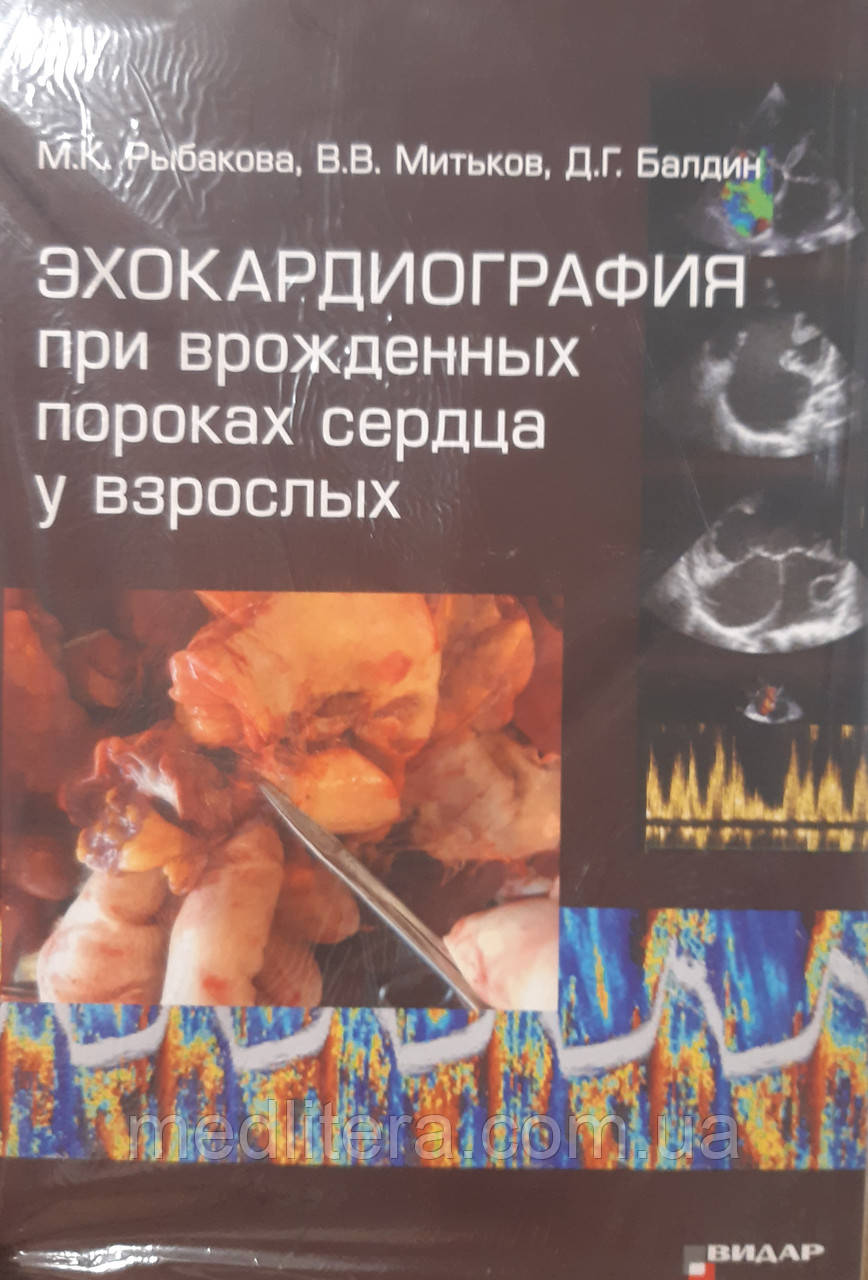 Ехокардіографія у разі вроджених вад серця в дорослих
М.К. Рибакова, В.В.Мітків, Д.Г.Балдин