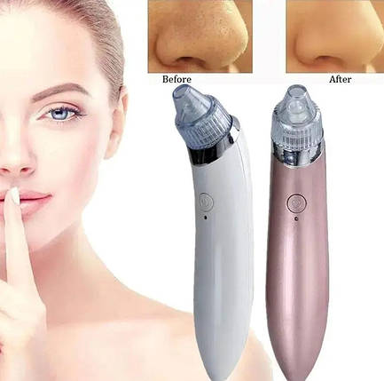 Вакуумний апарат для чищення пор Beauty Skin Care Specialist XN-8030, Апарат для чищення обличчя, SBm, фото 1
