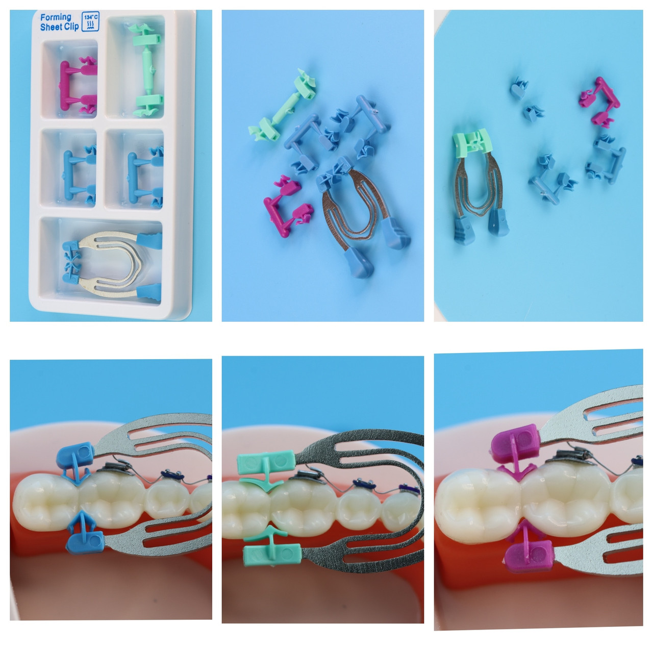 Стоматологические кольца для адаптации матрицы (аналог палодент)