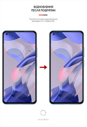 Гідрогелева плівка ArmorStandart Anti-Blue для Xiaomi 11 Lite 5G NE (ARM6284) прозора, фото 3