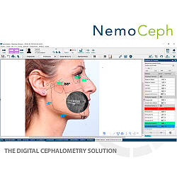 NemoCeph