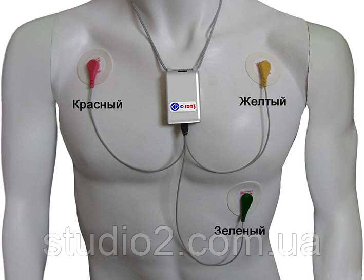 SDM3 (Холтер ЕКГ), цена 112000 грн — Prom.ua (ID#1666515457)
