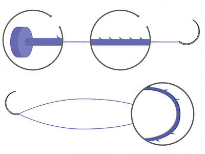 Хірургічна нитка з насічками Fibloc (Фіблок) аналог V-Loc