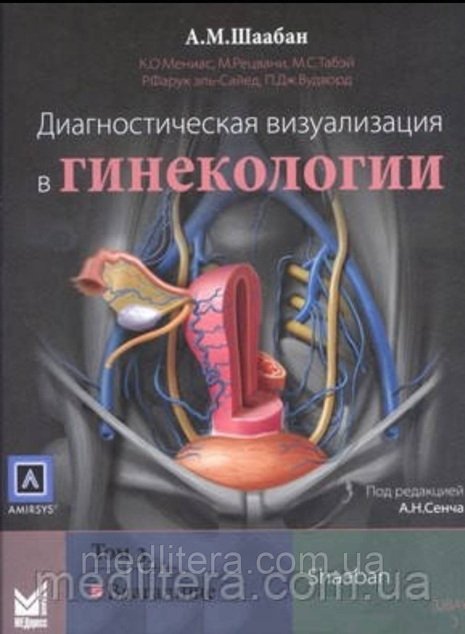 Шаабан А. М. Діагностична візуалізація в гінекології. Том 1, фото 1