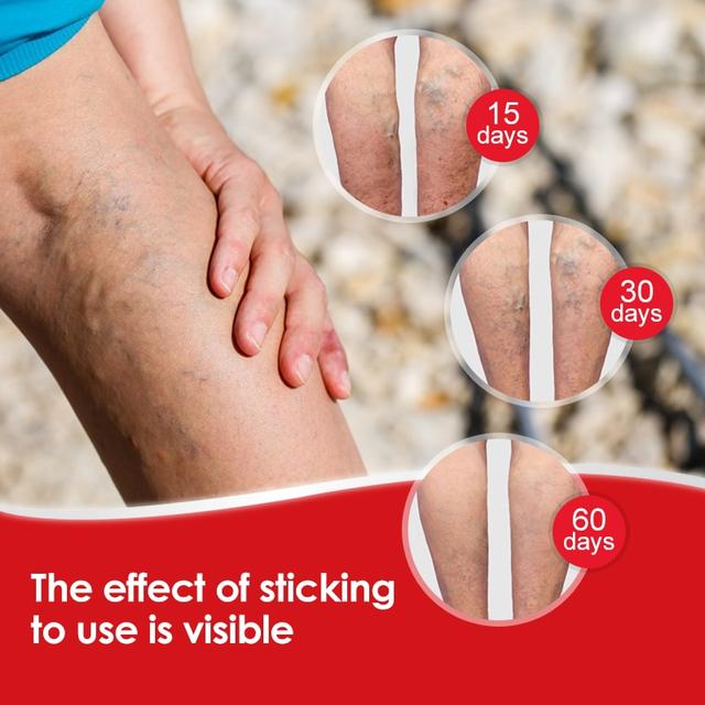 Пластырь от варикозного расширения вен с турмалином Гонконг 6 шт