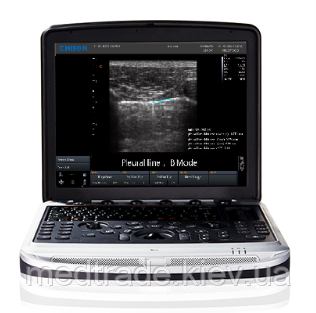 Ультразвуковий сканер SonoBook 8
