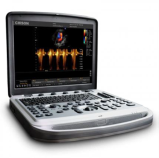 Портативний ультразвуковий апарат SonoBook 6