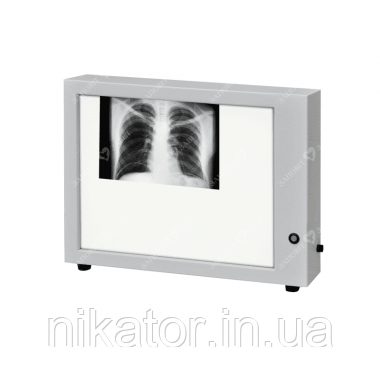 Негатоскоп Н-1