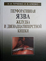 Перфоративна виразка шлунка та дванадцятипалої кишки. Тутченко Н.І., Журавлина І.В.. Монографія