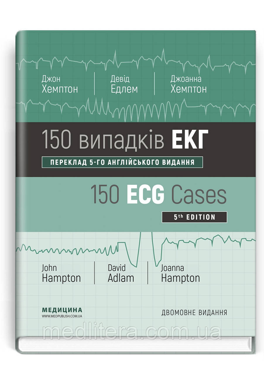 150 випадків ЕКГ: 5-е видання / Джон Хемптон, Девід Едлем, Джоанна Хемптон (дві мови)