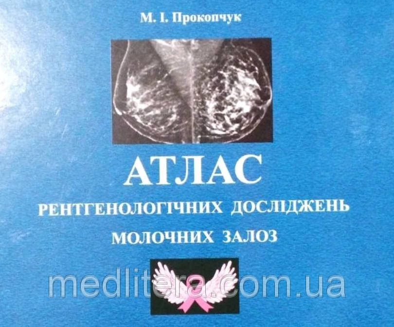Атлас рентгенологічних досліджень молочних залоз  М. Прокопчук, фото 1