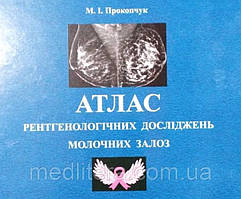 Атлас рентгенологічних досліджень молочних залоз  М. Прокопчук