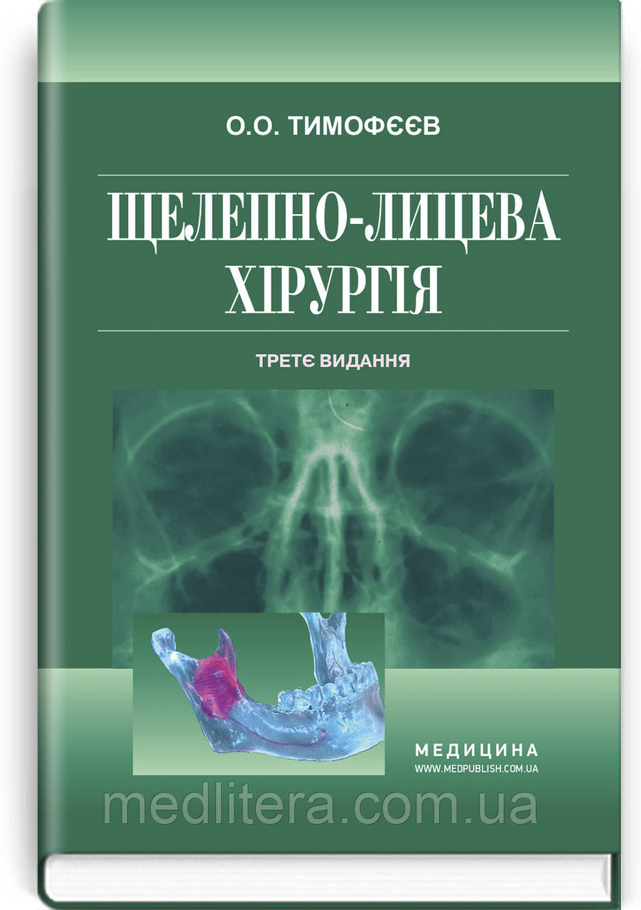 Тимофеев А.А. Челюстно-лицевая хирургия (укр)