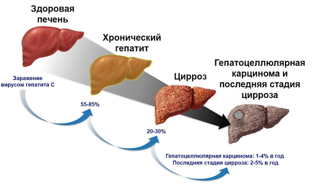 Гепатит. Малюнок 9.