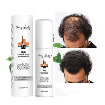 Спрей для росту волосся, проти випадіння волосся Omy Lady Hair Growth Spray, 60 мл | Limon, фото 1