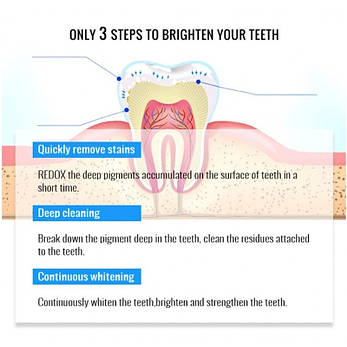 Єсенція для вибілювання зубів Omy Lady Teeth Whitening Essence, 10 мл | Limon, фото 3