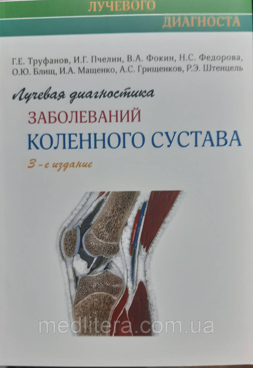 Труфанов Р. Е. Променева діагностика захворювань колінного суглоба 2-е видання