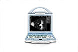 Ультразвуковий офтальмологічний сканер ODU5, ODU5, фото 4