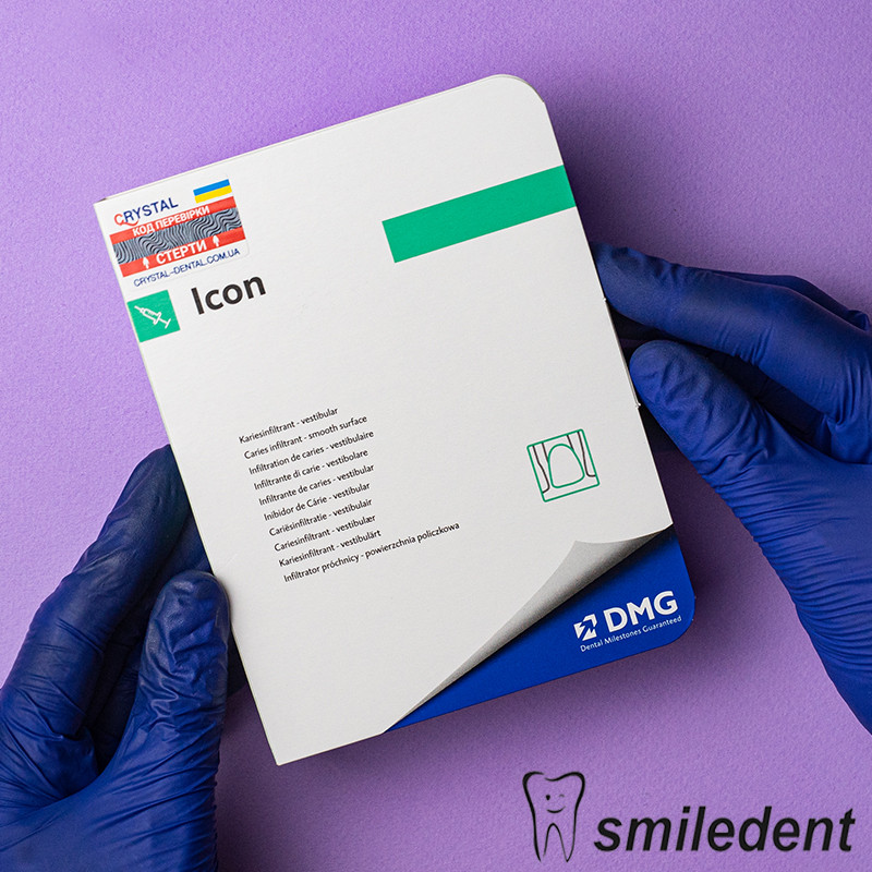 Icon (айкон) infiltrant-smooth surfaces, інфільтрація карієсу вестибулярних поверхонь.