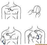 Оклюзійна пов'язка з клапаном Rhino Rescue Hyfin Chest Seal Vented вентильована торакальная оклюзивна наклейка наліпка, фото 2