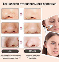Вакуумний апарат для чищення обличчя очищувач шкіри та пор Multi-Functional, фото 7