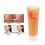 Золотий гель «Royal Facial Gel» для мікрострумів, міостимуляції., фото 5