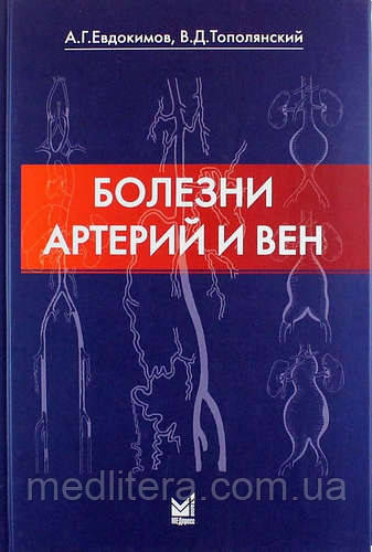 Тополянський Ст. Д., Євдокимов А. Р. Хвороби артерій і вен