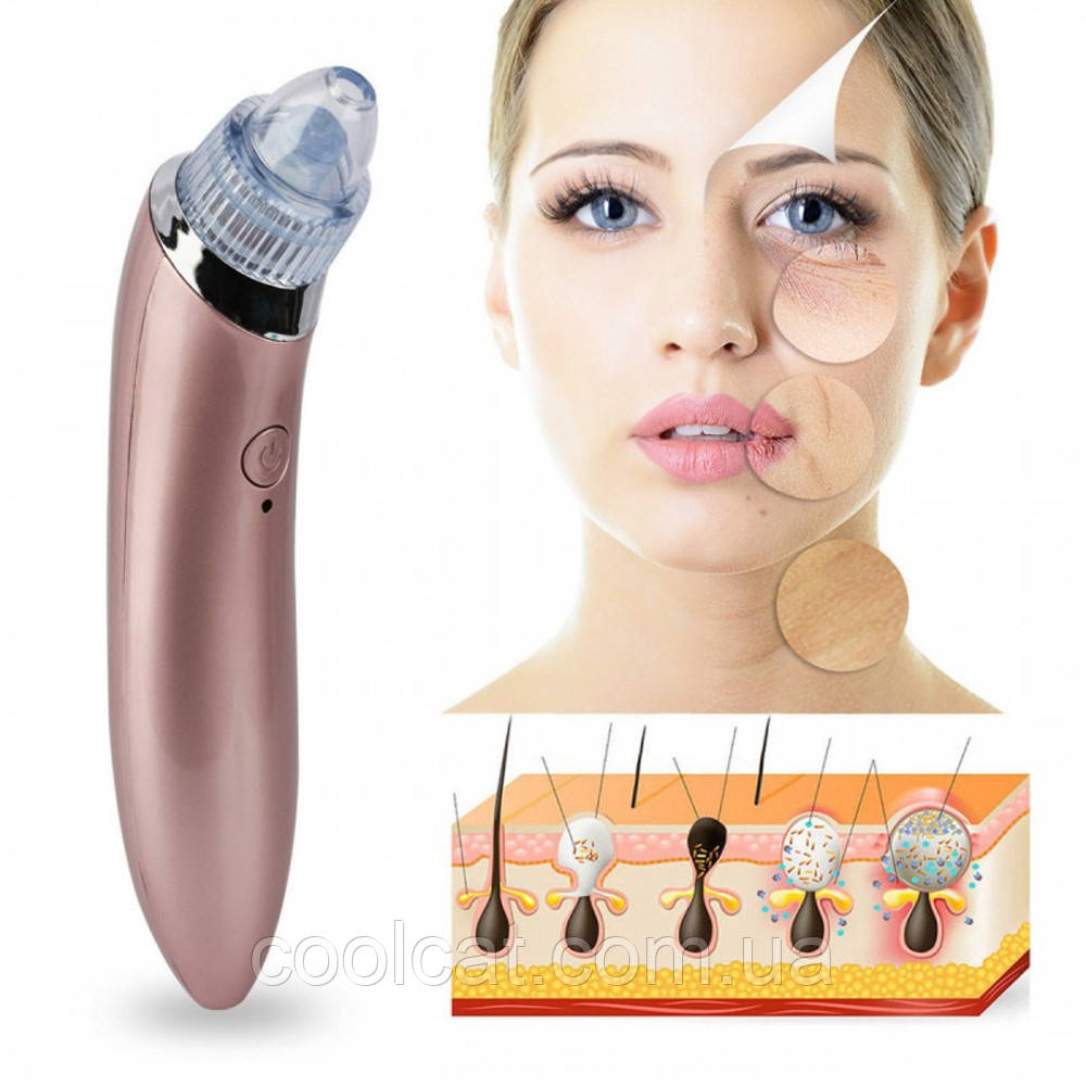 Вакуумный аппарат для чистки пор Beauty Skin Care Specialist XN-8030 + Подарок Маска для очищения пор - фото 2 - id-p1692428011