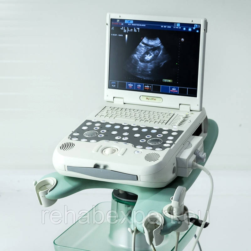 Портативный Аппарат УЗИ Esaote MyLab Five Portable Ultrasound System ...