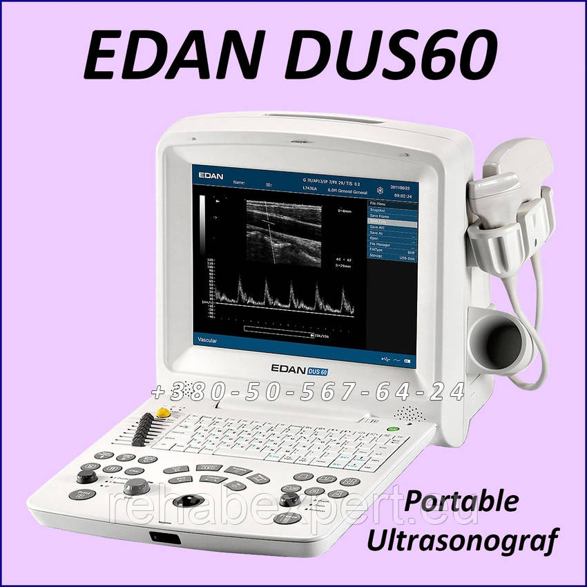 Ультразвуковий сканер EDAN DUS60 Portable Ultrasonograf (Used), фото 1