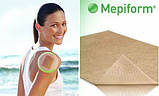 Мепіформ Molnlycke Mepiform 4x30см 5 шт. силіконовий пластир для лікування рубців, фото 3