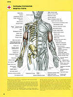Разрывы сухожилия бицепса плеча - плакат