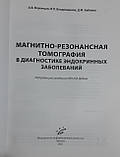 Магнітно-резонансна томографія в діагностиці ендокринних 2021, фото 2