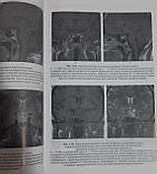 Магнітно-резонансна томографія в діагностиці ендокринних 2021, фото 5