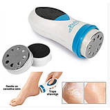 Пристрій для догляду за ступнями ніг Pedi Spin, фото 3