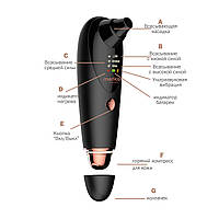 Вакуумний очисник шкіри та пор Medica+ Skincleaner 9.0 black (Японія), фото 8