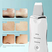Ультразвуковий скрабер Swan Ultrasonic Scrubber S1 уз для очистки обличчя ліфтингу та фонофорезу Ultrasonic Skin білий, фото 4
