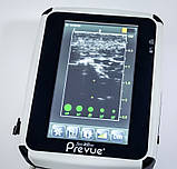 Портативна ультразвукова система BD Site-Rite Prevue + Portable Ultrasound System (Used), фото 4