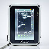 Портативна ультразвукова система BD Site-Rite Prevue + Portable Ultrasound System (Used), фото 5