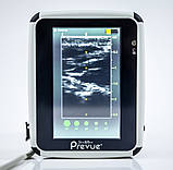 Портативна ультразвукова система BD Site-Rite Prevue + Portable Ultrasound System (Used), фото 7