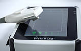 Портативна ультразвукова система BD Site-Rite Prevue + Portable Ultrasound System (Used), фото 2