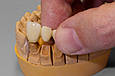 Гель для фіксації вінірів, коронок Fixing Gel, 5мл шприц, Yeti Dental (Німеччина), фото 6