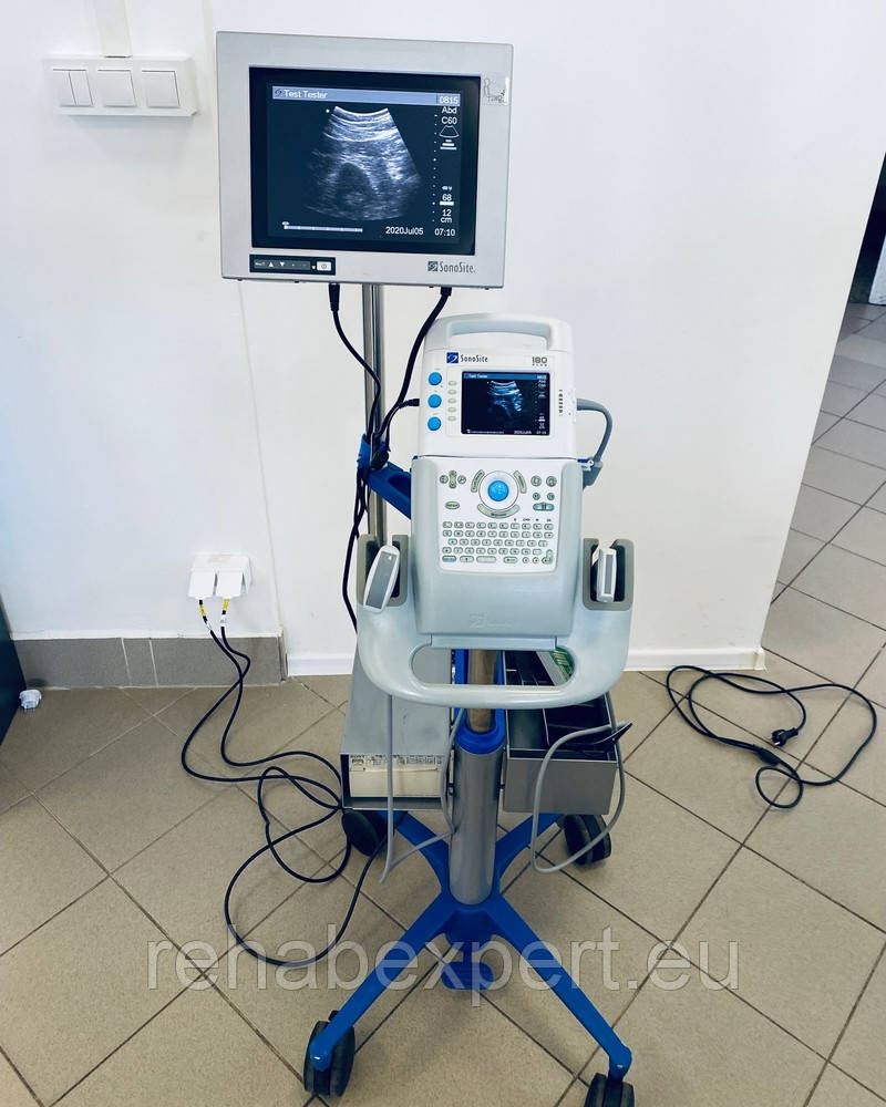 Б/У Портативний УЗД-сканер з кольоровим доплером Sonosite 180 Plus Portable Lightweight Ultrasound (Used), фото 1
