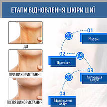 Мікрострумовий масажер ліфтингу шиї другого підборіддя та ультразвукової особи для підтяжки шкіри Lifting Pro MJ-32, фото 3