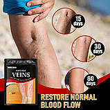 Пластир проти варикозного розширення вен із турмаліном, полегшення болю в ногах, набряк, пластир із дощовим червом, фото 4