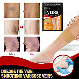 Пластир проти варикозного розширення вен із турмаліном, полегшення болю в ногах, набряк, пластир із дощовим червом, фото 5