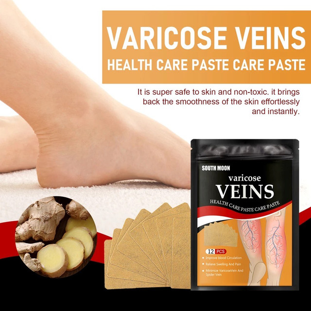 Пластырь от варикозного расширения вен, облегчение боли в ногах, отек, пластырь с дождевым червем