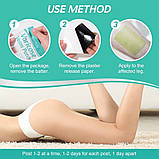 Пластир проти варикозного розширення вен і судинних зірочок на ногах 8 шт., фото 4